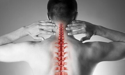 Servikal o'murtqa osteoxondroz qanday namoyon bo'ladi